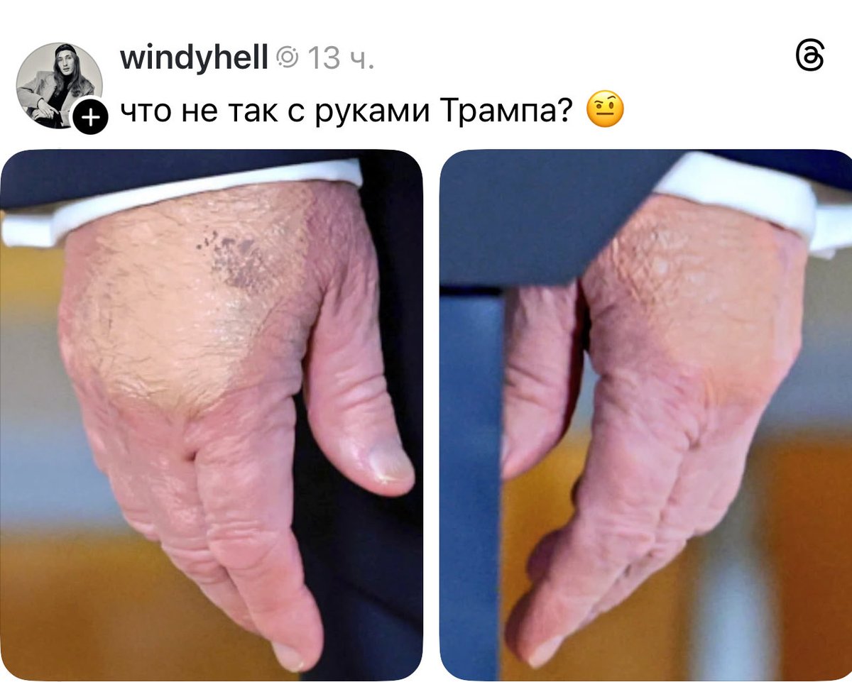 убивалочка tweet media