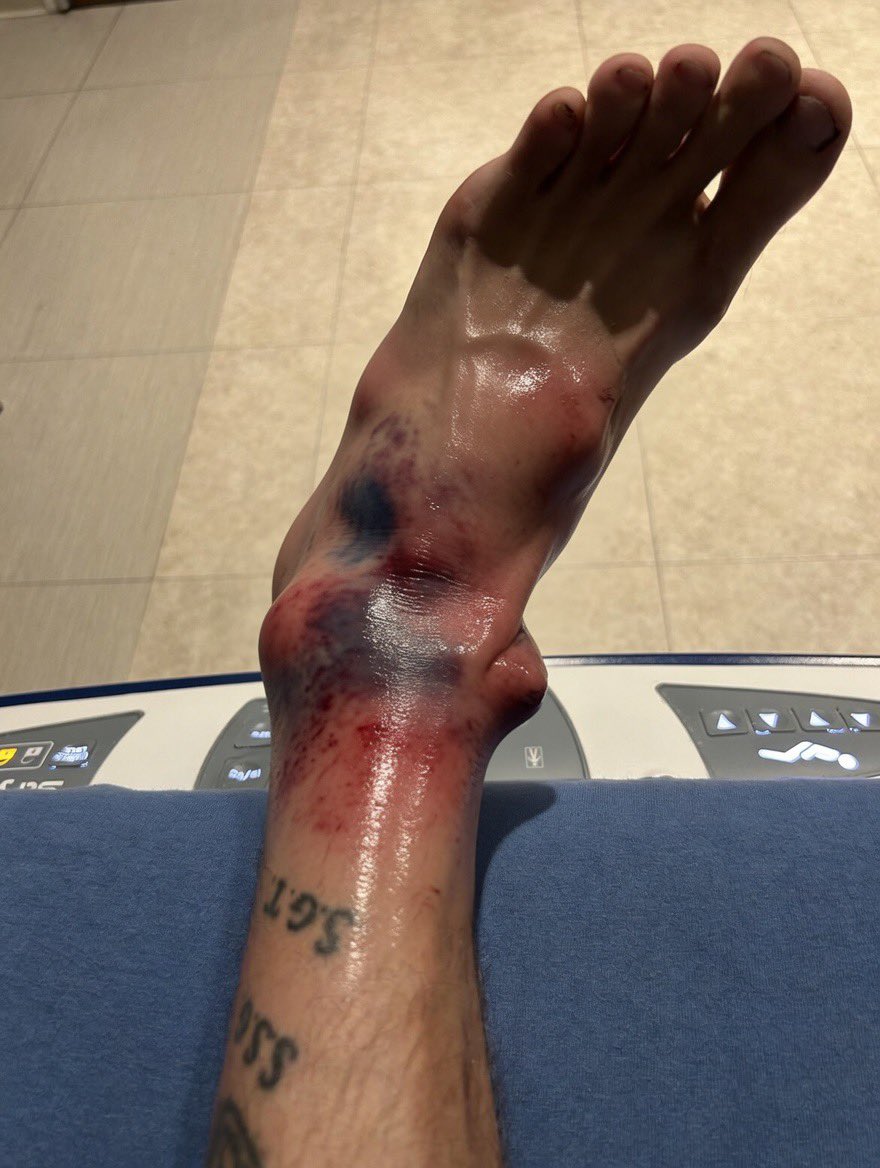 DelusionalBulI's tweet photo. @CrunchGym Is this how you treat our disabled Veterans by charging them a arm & a leg even tho we gave those limbs already? 

I haven’t even stepped foot into your gym as on March 26th my boat sunk and I treaded water for 12 hours until the Coast Guard found me per this video so I was down 1 1/2 months due to this accident so I wasn’t able to step foot inside your gym, and 2 weeks ago I had a trailer crush my ankle to which again I couldn’t step foot into your gym as I am still recovering… 

Yet only income right now is my VA Disability & you guys just took my water & electric bill money… Your customer service this morning told me to pound sand & wont refund me even though I have proof I never even activated my membership… 

Is this how you treat all of your customers or just disabled Veterans in Trinity Florida? 

All I wanted was my bill money back so my water and power doesn’t get turned off…
@TB_Times @10TampaBay @FOX13News @DeptVetAffairs