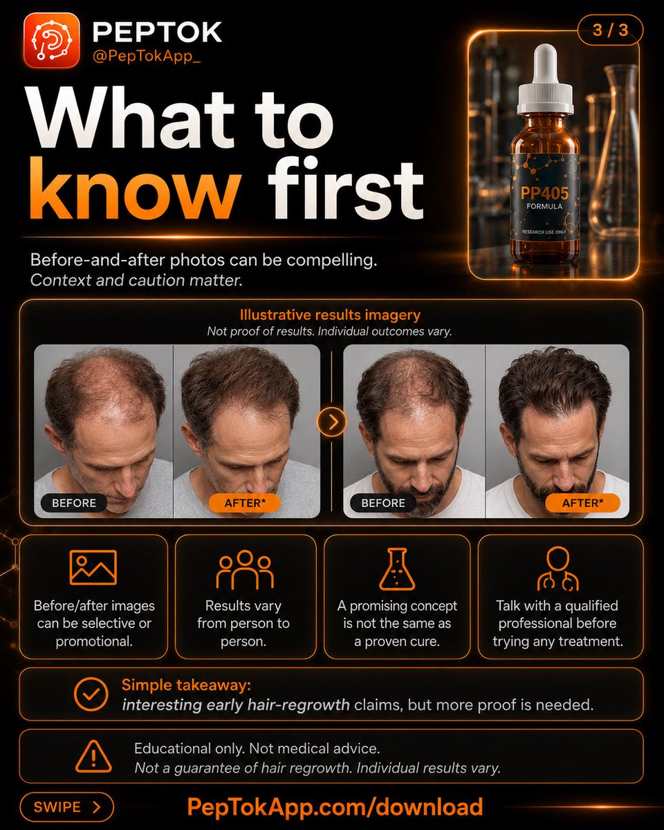 Peptok_'s tweet photo. Did Japan Cure Hair Loss? What the Reports Really Say

Viral hair-loss posts are making big claims about Japanese research, PP405-style compounds, and “dormant follicle reactivation.”

Early research may be interesting, but screenshots, viral headlines, and before/after images are not the same as established clinical proof. More validation, regulatory review, and real-world data are needed before calling anything a cure.

PepTok helps you track wellness routines, progress, protocols, and educational health insights in one place.

Educational only. Not medical advice. Not a treatment claim. Not a guarantee of hair regrowth. Online claims may be preliminary, promotional, or unverified. Always consult a qualified healthcare professional before making health decisions.

https://t.co/a2mlVIqcXC

#PepTok #HairLossResearch #HairRegrowth #HealthEducation #Biotech