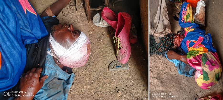 AND SO, IT CONTINUES....

VIEWERS DISCRETION IS HIGHLY ADVISED 🚨🚨🚨‼️‼️‼️

SECURITY REPORT

Today 8th May 2026, around midnight ,Fulani militias attacked Ngbrran-zongo village, Kwall district Bassa LGA killing 11 Irigwe persons.

Details of the attack is as follows:
Killed
1.