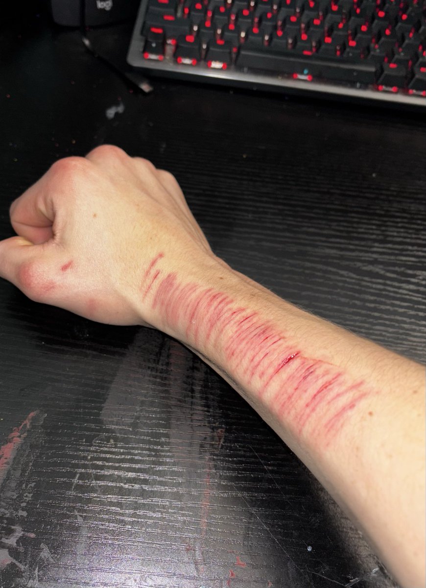 tw: fresh cuts
i hate myself