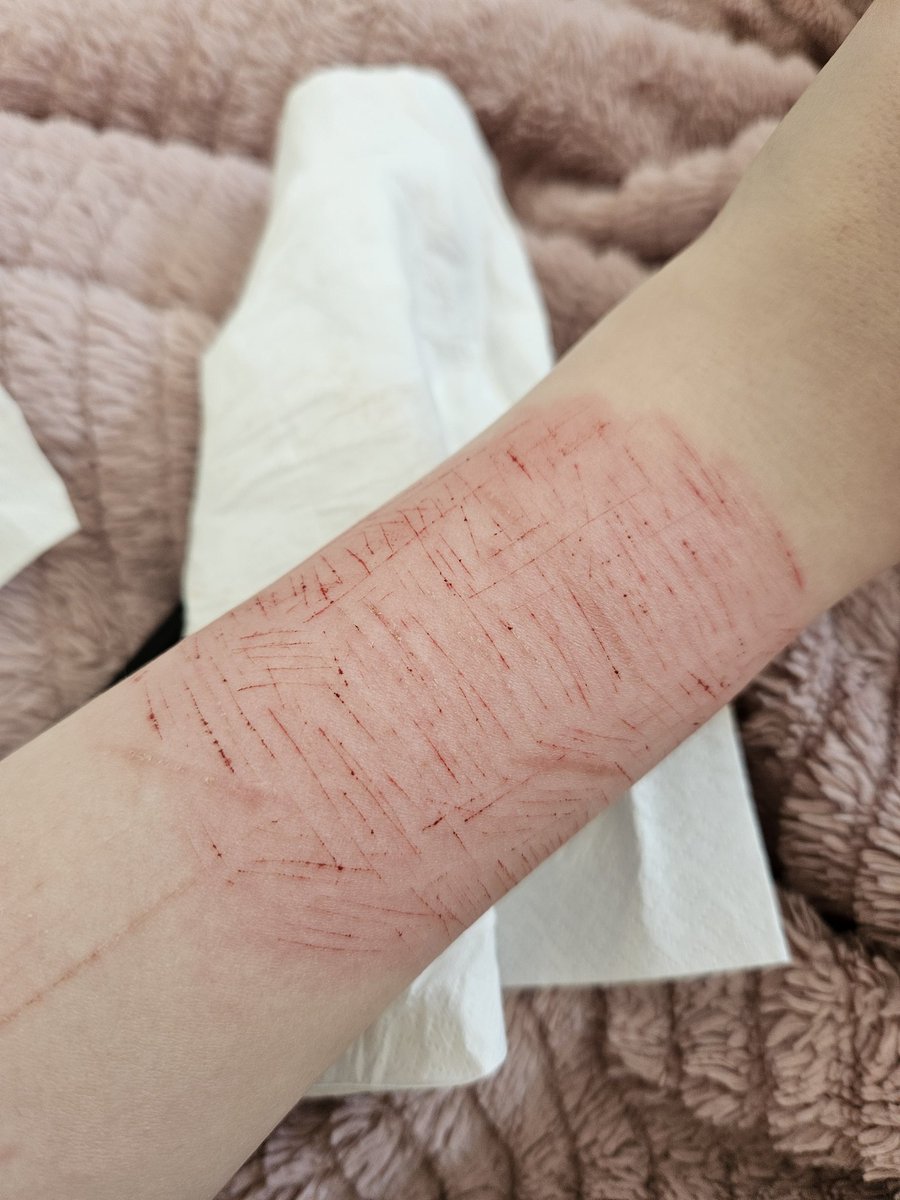 Elise1443853's tweet photo. Sesh i did with box cutter
FAKE
#shedtwt #shtwt #slightly #meow https://t.co/SxzTaoTBYX