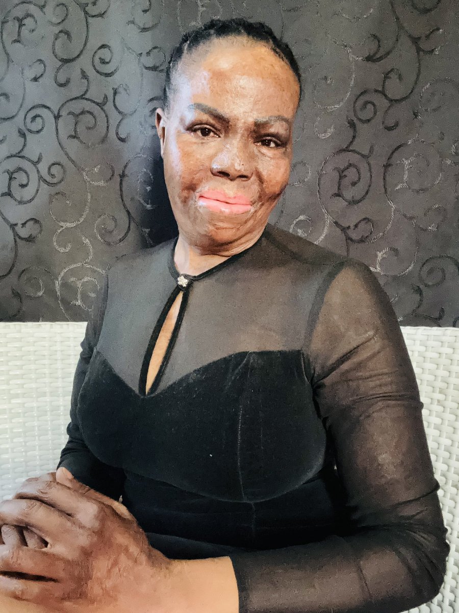 MissT 🇿🇦 The Invincible 🤍🌻 tweet media