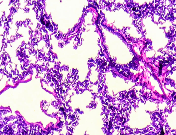 ScienceMagazine's tweet photo. New @SciSignal research performed in vitro and in mice clarifies the molecular origins of uncontrolled inflammatory immune responses in the lungs—a common and severe complication of lung infections. https://t.co/gq7uimBRvV https://t.co/RzxRkZqgFb