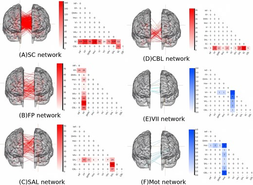 PSYRAD2's tweet photo. https://t.co/hGlQsEGR83
Why do we need brain networks to understand gaming addiction?
🔹Traditional research doesn't fully explain IGD severity variability. 
🔹Mapping large-scale network communication is key for reliable biomarkers. 🗣️🌐
 #InternetGamingDisorder #CPM #Brain https://t.co/U8mRN7OMOm