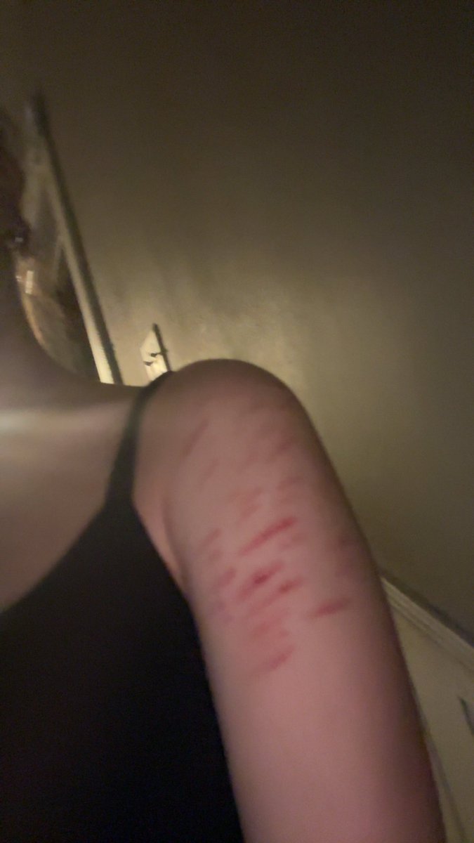 ݁˖Bevy🦴˖ ݁𖥔 ݁ tweet media