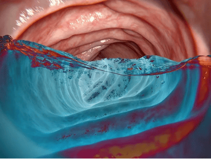 The Practicing Endoscopist tweet media