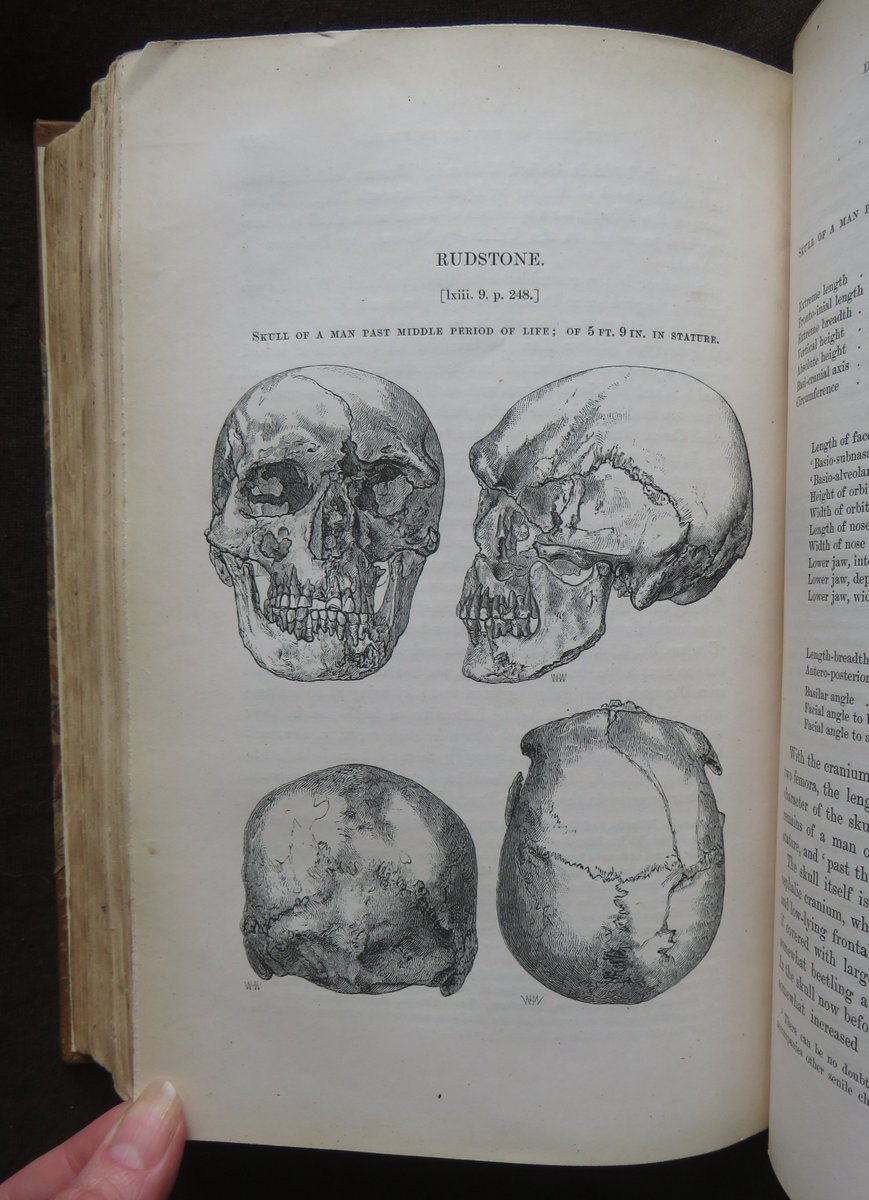 wisdompedlars's tweet photo. BRITISH BARROWS SEPULCHRAL MOUNDS 1877 GREENWELL 1st ARCHAEOLOGY Illustrated SKULLS

#books #antiquarian #history #British #archaeology #barrows #firstedition #skulls #anthropology #diggingforbritain #bookauction 
https://t.co/NCxKyAmbKl https://t.co/wIodl2VEyv