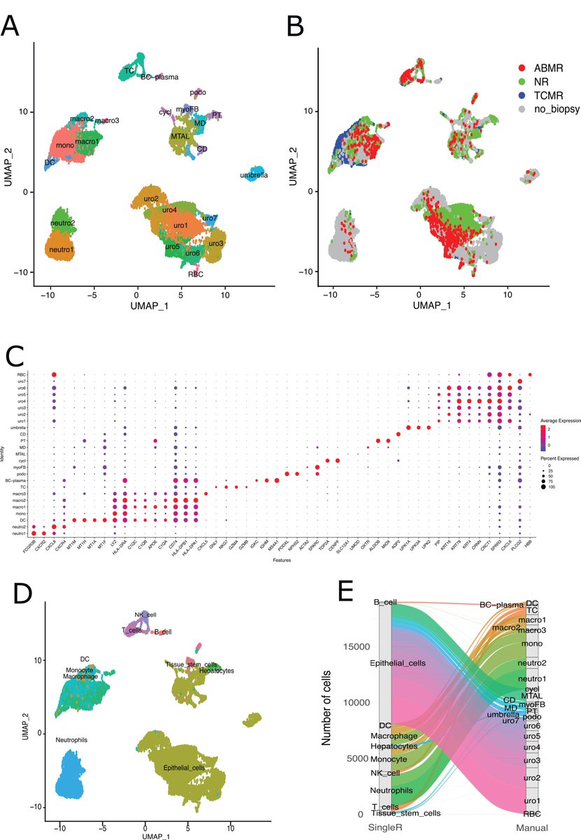 WCMQresearch's tweet photo. Urinary Single-Cell Transcriptomics in Kidney Transplantation: Elucida... https://t.co/gXNIJbucOO Led by @WeillCornell @WCMQatar the study shows how urinary scRNA-seq enables noninvasive, real-time insight into immune activation, injury &amp; graft adaptation. https://t.co/O3IwMQ89Bl