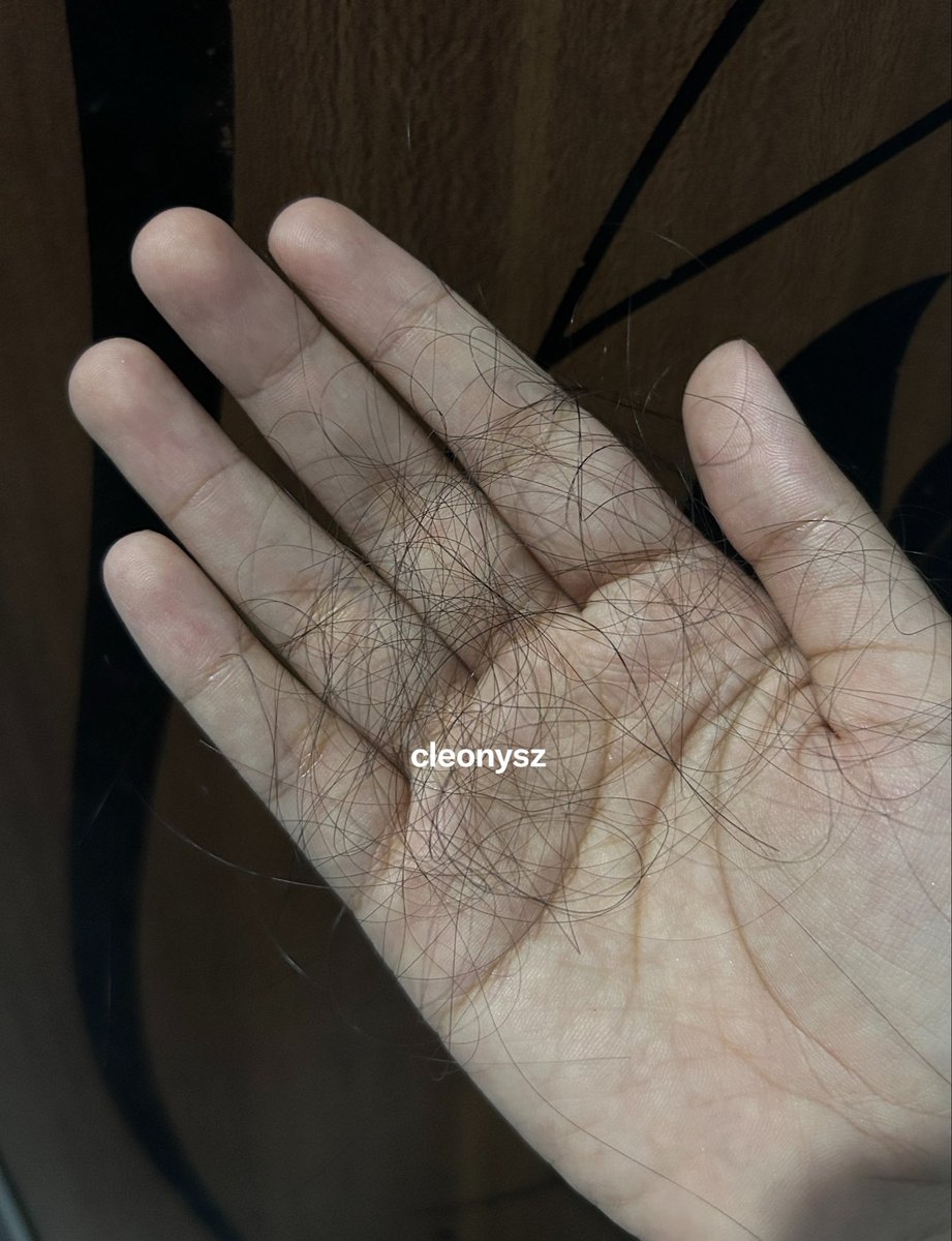 cleonysz's tweet photo. dulu aku sepele banget sama rambut rontok. mikirnya, karena pakai kerudung jadi yaudah gak ada yang tau juga. ternyata makin lama, bikin stres kalau nyapu kamar, yang kekumpul bukan debu tapi rambut😭 padahal berharap yang kekumpul tuh duit😆 https://t.co/jhbr79c11b