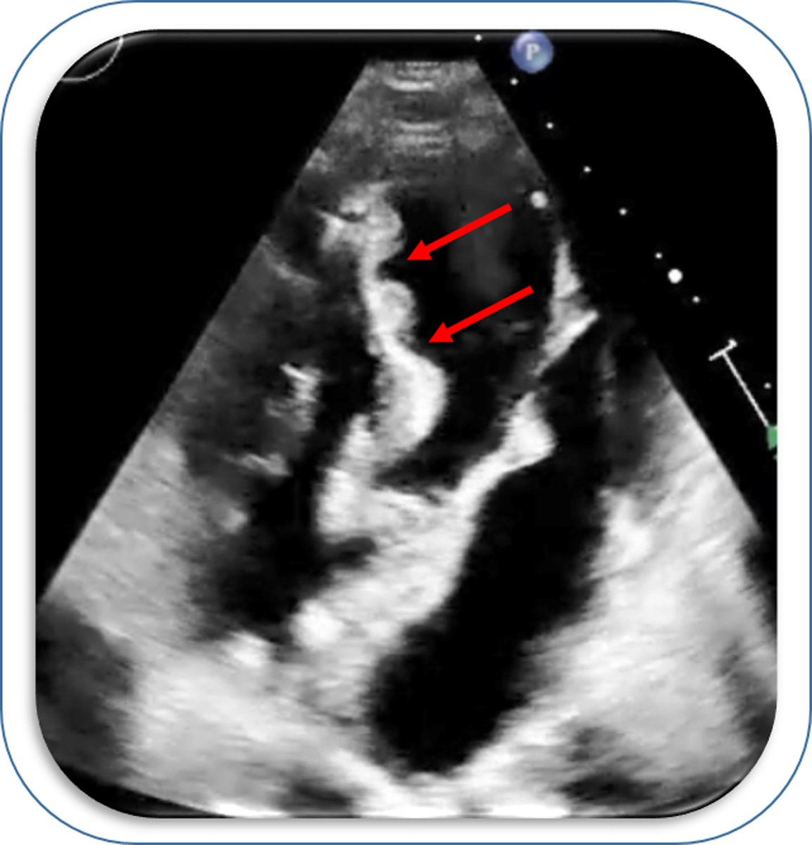 European Society of Cardiology Journals tweet media