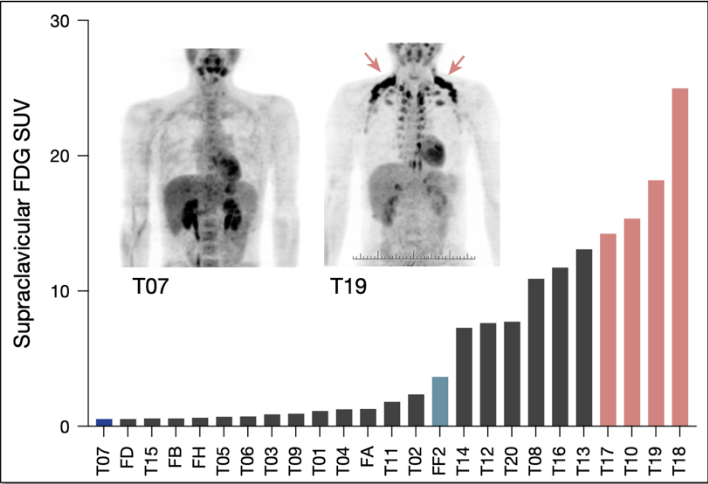nicknorwitz's tweet photo. 5/5) Good news!

A brand-new paper may finally explain how this happens and answer those questions! There’s something going on in some of – the metabolically ‘gifted’ – and there may soon be a way to replicate it.

Check out the full letter: https://t.co/Eyt0EzeMmJ https://t.co/0rIaGIVaXH