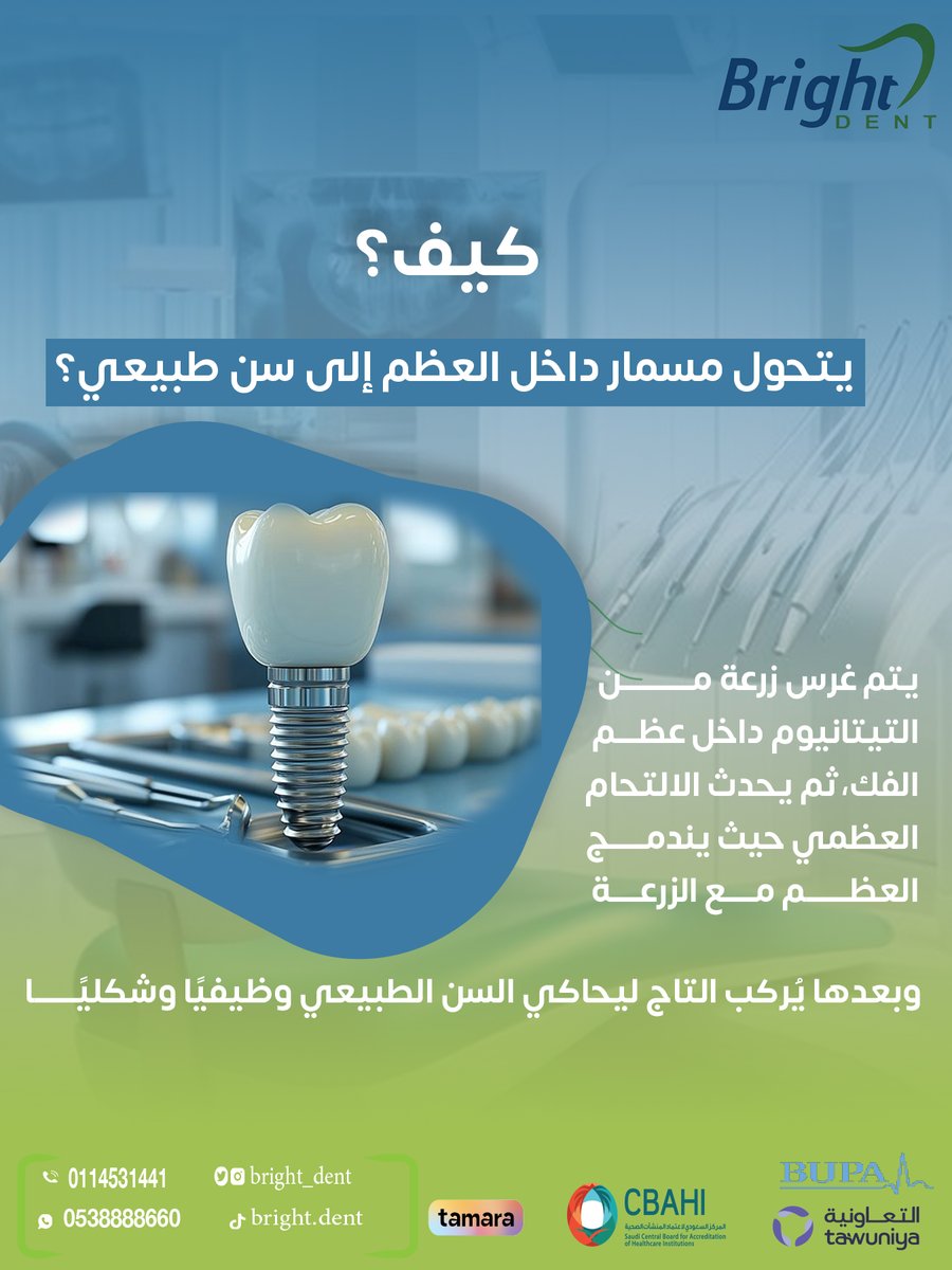 Bright_dent's tweet photo. ببساطة… يندمج مع العظم مع الوقت ويصبح قاعدة ثابتة تُركّب عليها تاج يشبه السن الطبيعي في الشكل والوظيفة.

#زراعة_الأسنان #طب_الأسنان #زراعة_الزرعات #ابتسامة #تجميل_الأسنان https://t.co/PE2WjZ1uPW