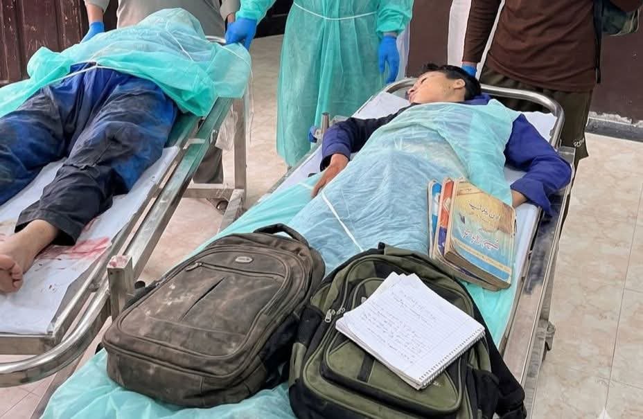 MyamiWazir's tweet photo. زه سکول ته ځم راپسې راشه
که چرته مړ وم بيا مې راوړه کتابونه

( I am going to school come pick me if i found killed then bring back the books to my home )

#Bajuar https://t.co/F21Sgy0UHR