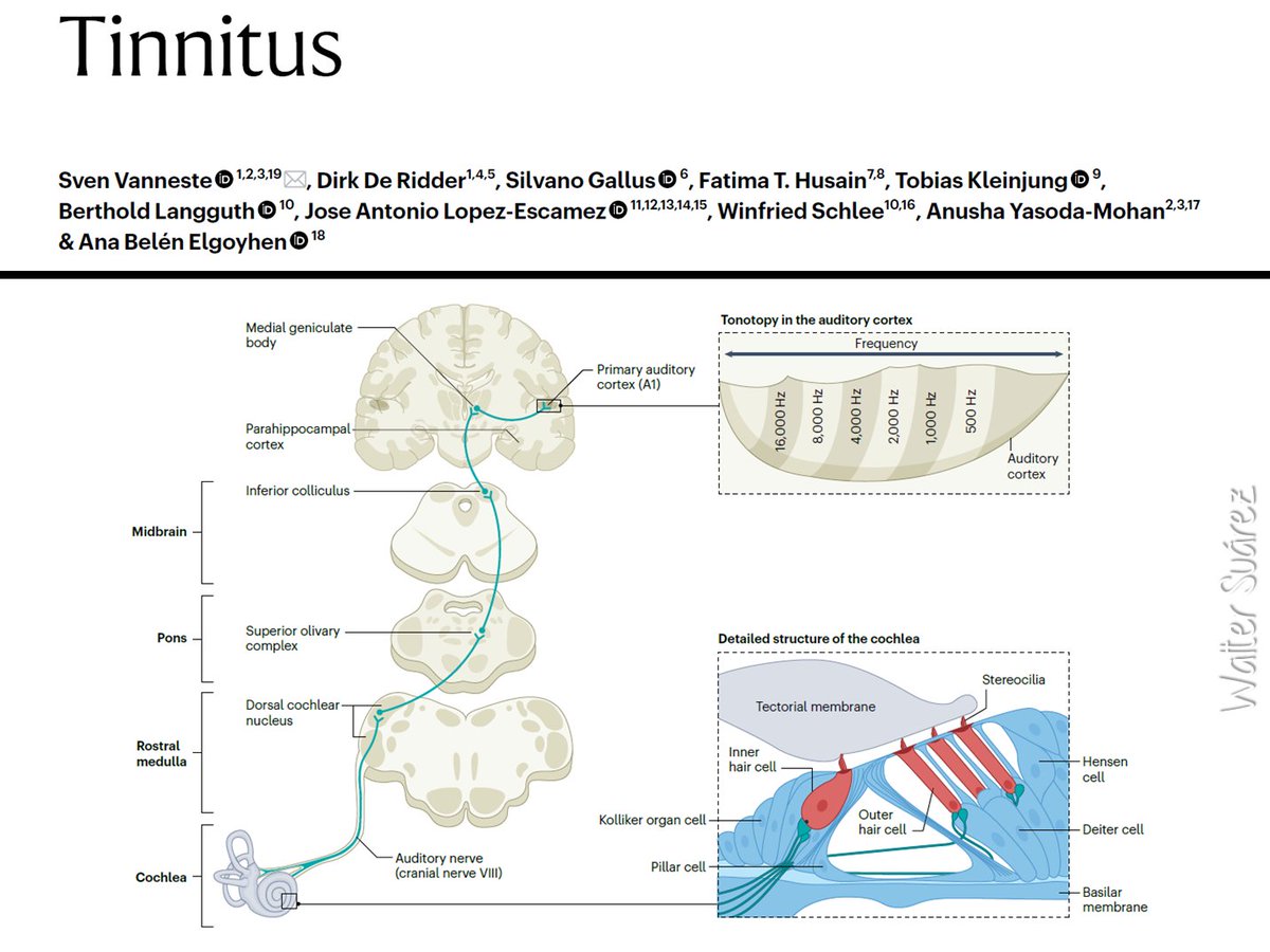 a_fisiolog57853's tweet photo. TINNITUS

¡¡¡A leer, zagales!!!

Link en mi bio

o

https://t.co/Z1Z3NI2hAA https://t.co/rJIg8CYtD6