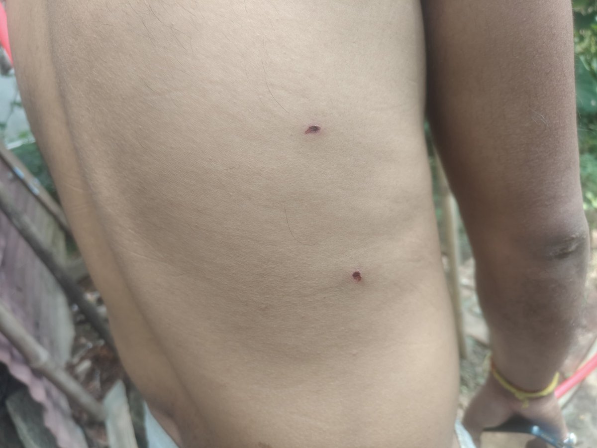 Arijitjournal's tweet photo. Case No. 79/26 under  — no accused arrested yet in my kidnapping &amp; brutal attack case. As a journalist, I seek justice and a fair investigation. Truth cannot be hidden forever.@DGPAssamPolice @himantabiswa @narendramodi @sarbanandsonwal @India_NHRC @dchojai @PCITweets https://t.co/vCBlOk2W0n