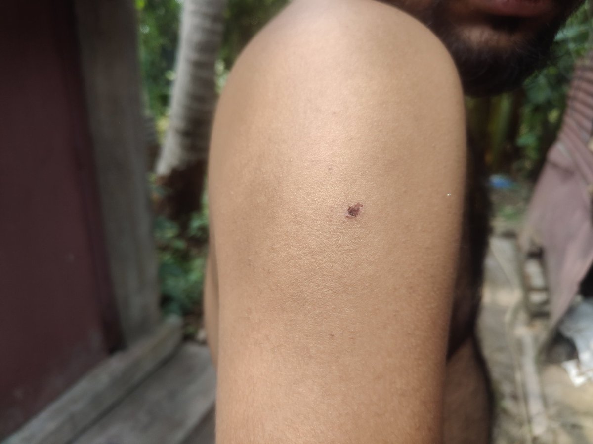 Arijitjournal's tweet photo. Case No. 79/26 under  — no accused arrested yet in my kidnapping &amp; brutal attack case. As a journalist, I seek justice and a fair investigation. Truth cannot be hidden forever.@DGPAssamPolice @himantabiswa @narendramodi @sarbanandsonwal @India_NHRC @dchojai @PCITweets https://t.co/vCBlOk2W0n