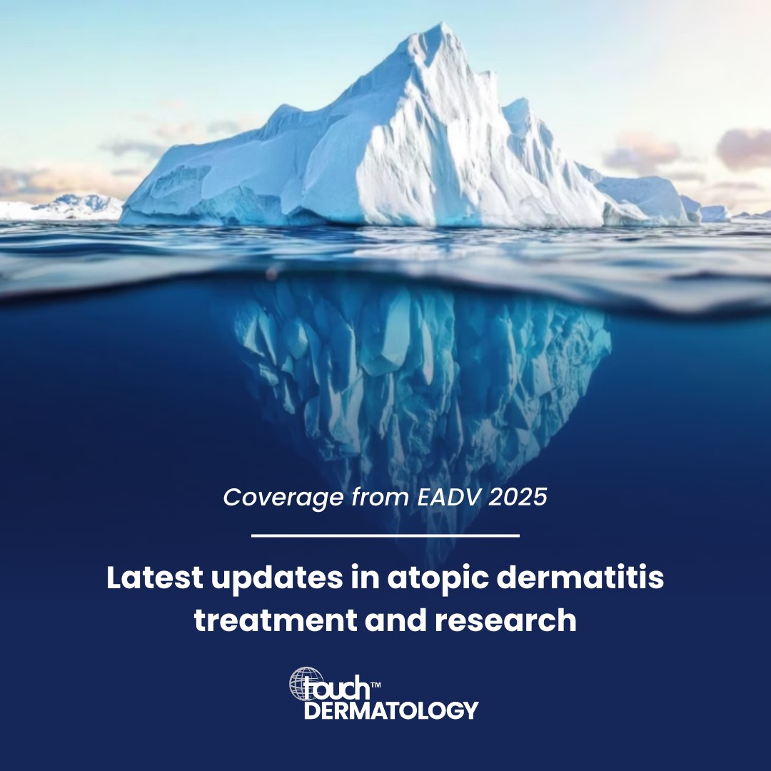 touchDERM's tweet photo. 💡Latest Updates in Atopic Dermatitis Across All Ages

At EADV 2025, Prof. Carsten Flohr highlighted key advances in atopic dermatitis (AD) care:

🔹 Preclinical AD – identifying infants at risk before inflammation begins using biomarkers and microbiome signatures.
🔹 Preventing food allergies – how skin barrier disruption can trigger allergies.
🔹 Novel therapeutics – new topicals and emerging systemic targets.
🔹 Skin microbiome & mental health – exploring the gut–skin and skin–brain axes.

📖 Read more:
https://t.co/ZSHp2oqMgK

#AtopicDermatitis #Dermatology