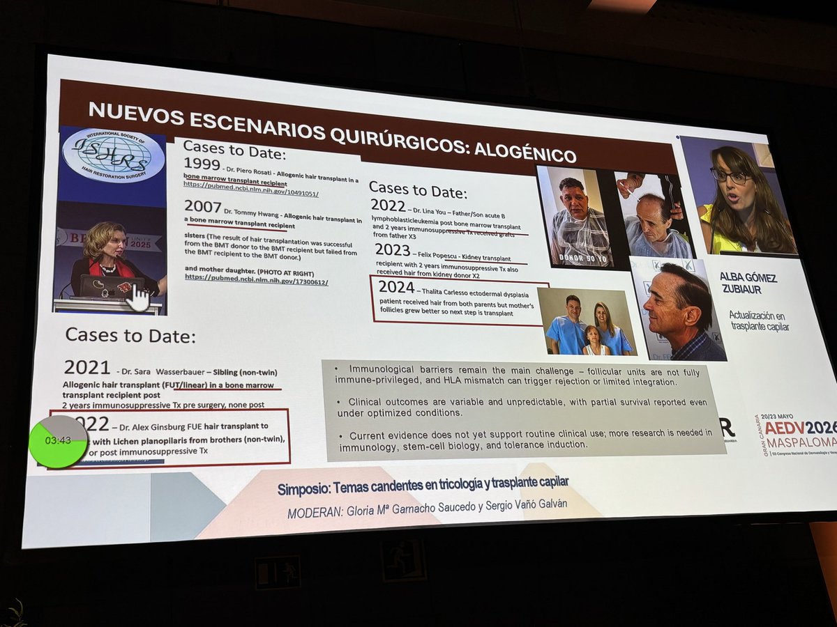 allobe86's tweet photo. Si queréis donar pelo a vuestros amigos…técnicamente es posible.

#AEDV2026 https://t.co/z2eDAv8QqJ