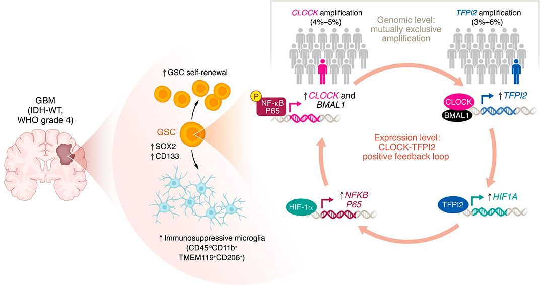 jclinicalinvest's tweet photo. Uncovering a feedback loop in #glioblastoma that reinforces stemness and immunosuppression: https://t.co/miSHi9vNP7

@DanielJBrat &amp; colleagues @NUFeinbergMed provide a Commentary on Zhou et al.: https://t.co/43Yq4F0Ckg https://t.co/7X6efZeNCi