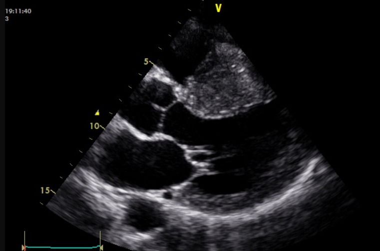 Cardio_delaGuia's tweet photo. 🚨 ¿Tienes Miocardiopatía Hipertrófica (MCH)? ¿Te prohibieron hacer ejercicio por miedo a la muerte súbita?
Un nuevo aporta datos interesantes 
Dentro HILO #CardiologíaDeportiva 👇🧵 #SportsCardiology @GTDeporSEC @secardiologia @preventiva_SEC @SVCardio  https://t.co/X8EkcQUhMK https://t.co/PdFxOAc2NT