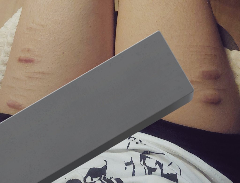 hxart7's tweet photo. #selfharm https://t.co/QSjftvqpiU