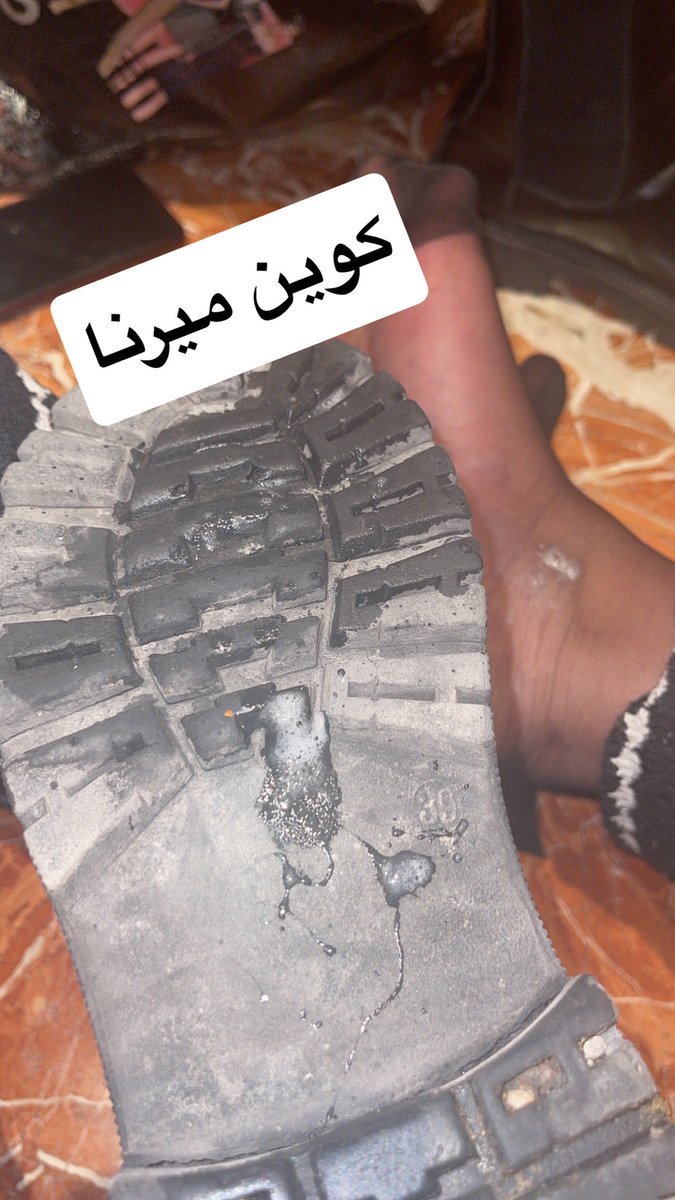QueenMerna2026's tweet photo. بدها تنظيف https://t.co/DemXTnzpLr