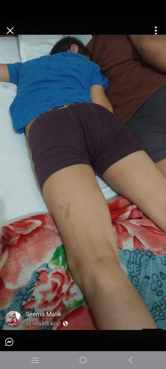 Hena112233s's tweet photo. @aajtak @ABPNews @ZeeNews @News18India कई parents द्वारा Patanjali Gurukulam से जुड़े बच्चों की सुरक्षा, चोटों, स्वास्थ्य एवं refund संबंधी गंभीर शिकायतें लगातार सामने आ रही हैं। संबंधित रिकॉर्ड, मेडिकल रिपोर्ट एवं सोशल मीडिया पोस्ट उपलब्ध हैं। कृपया मामले की निष्पक्ष जांच करें। https://t.co/mdqhXGA9G1