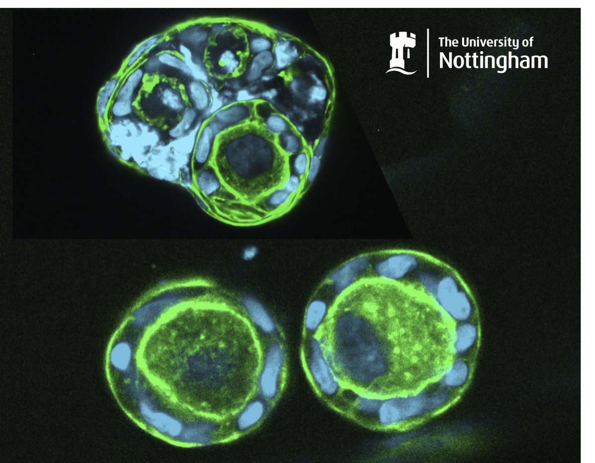 AlberioRamiro's tweet photo. 📢We are looking for a motivated reseacher to join our in vitro gametogenesis program. If you are interested in germ cell biology, click on the link for more details: https://t.co/JRf3xAnmDw #stem #gametogenesis #notinthegenes https://t.co/bcaWSGb1CL