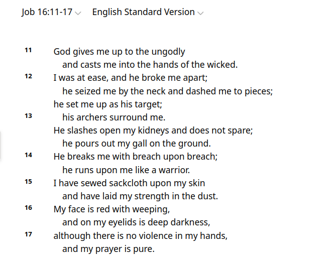 umbratilem's tweet photo. I am always struck by this part of blessed Job mystically prefiguring the suffering of the Messiah; the fathers also comment on this https://t.co/pRsbea8U30