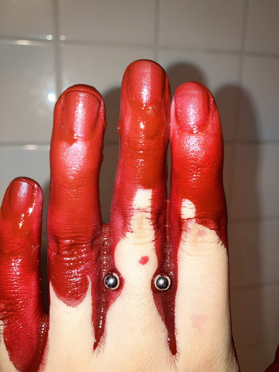 masshirone's tweet photo. #blood https://t.co/gnNpOUL790