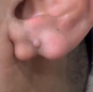 BadKujo's tweet photo. @Rainmaker1973 Can we talk about that earlobe? https://t.co/tRxfU5yzbO