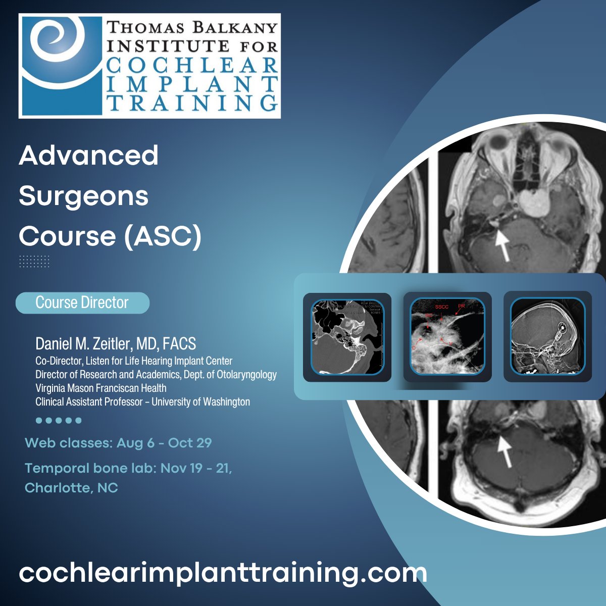 cochlearimplant's tweet photo. Cochlear implant training for surgeons.
Improve outcomes.
Hands-on temporal bone lab: advanced surgical techniques, difficult-case strategies, pediatric implantation skills, and more.

🔗 https://t.co/trKvz8fgV2 https://t.co/aerxIVseQ7