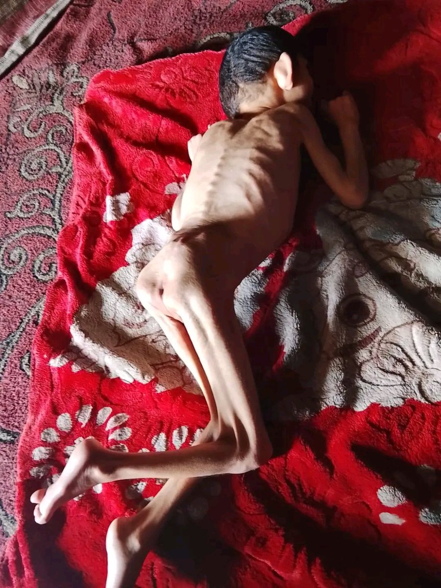 Just $30
$30won't make you poor, but it could mean everything to me.
Every donation helps me buy food, water, 
You know I'm the only breadwinner for a family .
Please, my friends, don't ignore this call for help👇
gofund.me/017c79c6e
