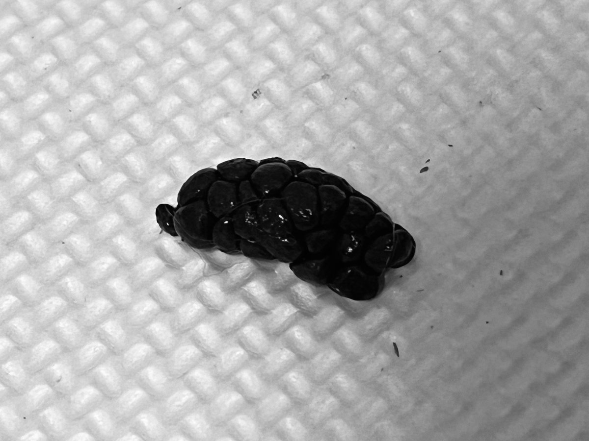 Blog_Mareeba's tweet photo. ブドウの房状の軟らかい便は盲腸便と言います。

本来は盲腸便を食べて栄養素を摂取しますが栄養過多によって盲腸便が多いと食べ残すことがあります。

その場合、まずはおやつ類の量を減らし、それでも変化がなければペレットの量を少し減らす生活を1ヶ月程続けると盲腸便は減るかもしれません。
(ペレットを減らす場合はまず獣医師に相談して下さい。)

食生活を変えても盲腸便が減らない場合は関節の痛みや神経症状、肥満などによりそもそも食べることができない等、別の要因が考えられます。
#うさぎ #うさぎの病院