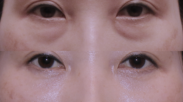 韓国ST美容整形外科 tweet media