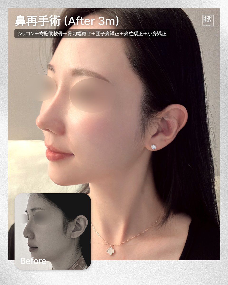 【公式】ハイエンド整形外科 tweet media