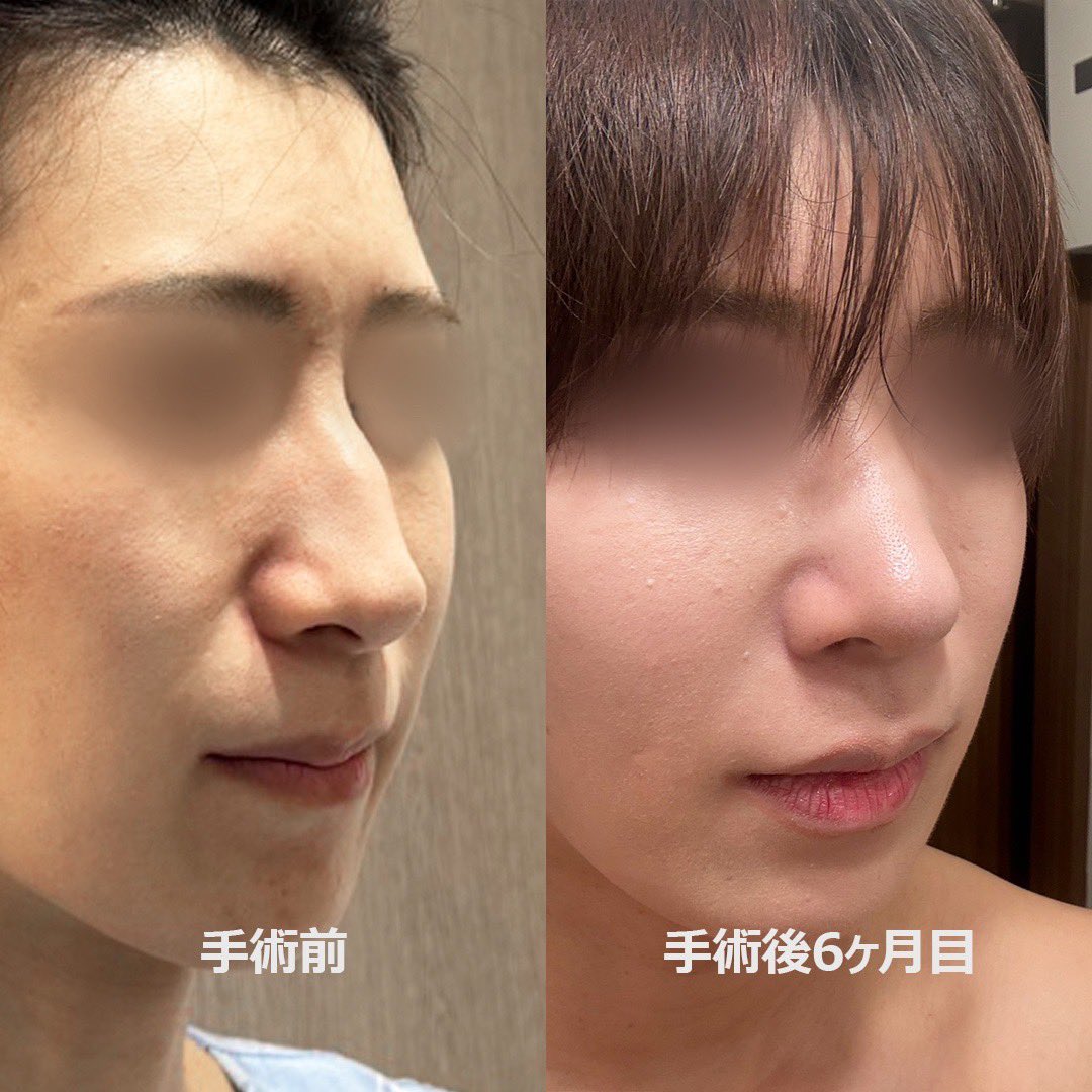 もも tweet media