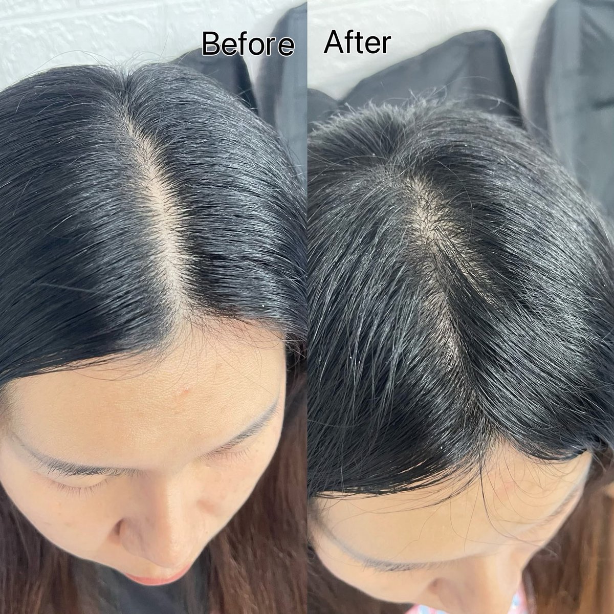 yoya11232's tweet photo. ผมร่วงเป็นกำจนเครียด 😭
ลอง เคลียร์สูตรโปร แฮร์ฟอล / Clear Scalp Pro
7 วัน = ร่วงน้อยลง + กล้าหวีผมขึ้นจริง
Before/After เห็นชัดเลย 🥹✨
เราได้มาจาก watsons ทุกคนไปดูโปรได้เลย #CLEAR #แชมพูลดผมร่วง #ผมร่วง #เซรั่มบํารุงผม https://t.co/85yWPSuubO