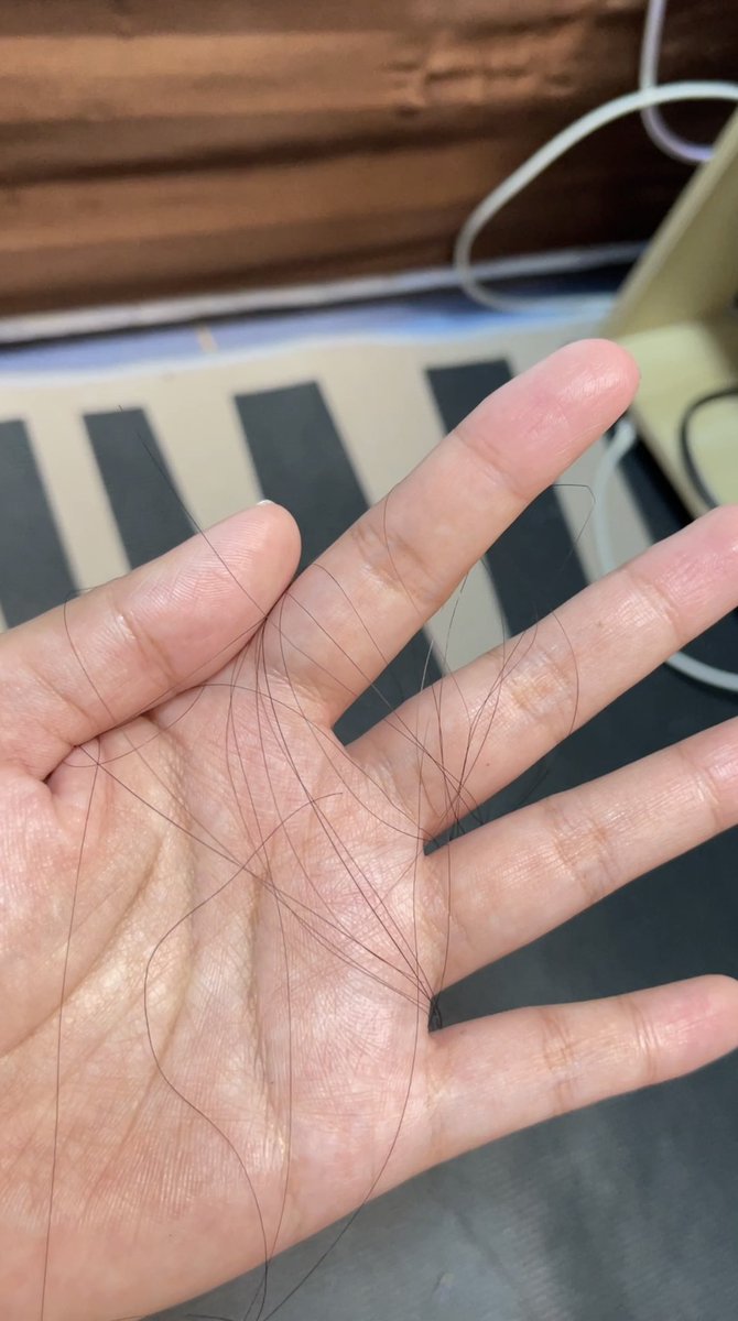 yoya11232's tweet photo. ผมร่วงเป็นกำจนเครียด 😭
ลอง เคลียร์สูตรโปร แฮร์ฟอล / Clear Scalp Pro
7 วัน = ร่วงน้อยลง + กล้าหวีผมขึ้นจริง
Before/After เห็นชัดเลย 🥹✨
เราได้มาจาก watsons ทุกคนไปดูโปรได้เลย #CLEAR #แชมพูลดผมร่วง #ผมร่วง #เซรั่มบํารุงผม https://t.co/85yWPSuubO