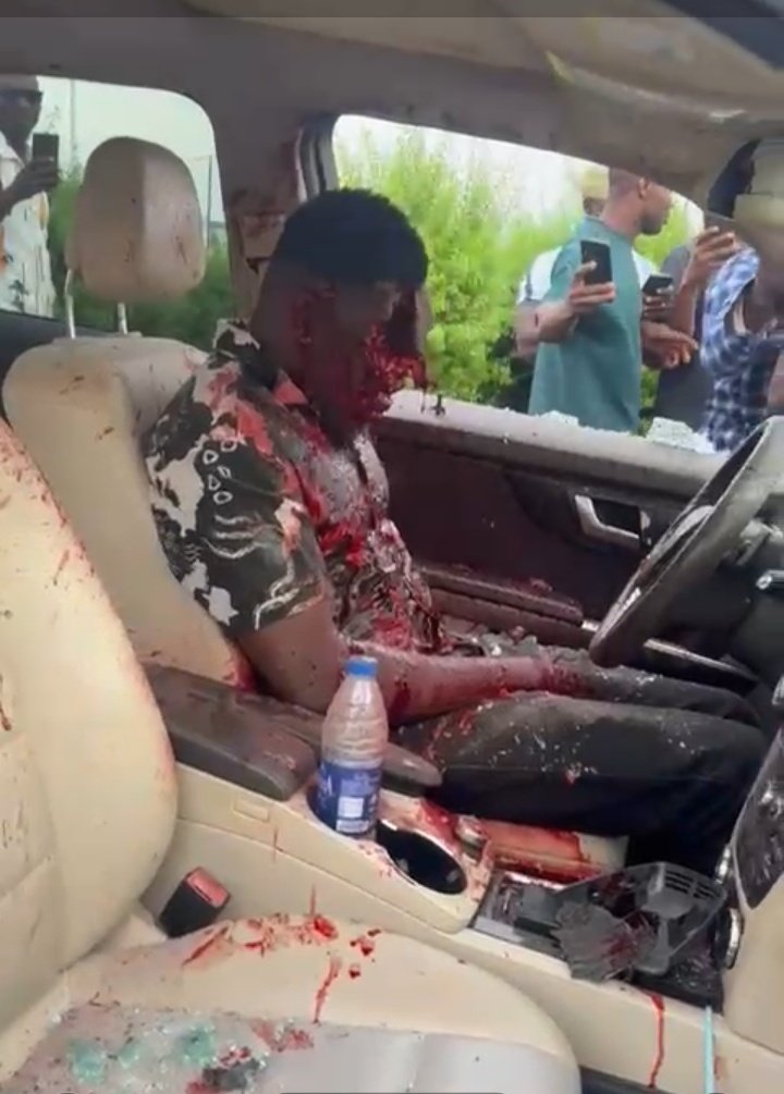 Rhapxodyy's tweet photo. According to the information I gathered from Junior's closed friends, Junior was a part-time final year student of University of Benin (UNIBEN) who just finished writing his exam and was cruising out of the school with his beige colour Mercedes Benz GLK with his girlfriend sitting at the front seat, and his course mate (Guy) sitting at the passenger back seat. 

I was told he had a Yahoo deal with an unknown guy, which money was dropped to his aza as a Azaman, and he told his Associates that the money died in Aza.

Over 70 million, and has been stubborn about it. He has received several calls regarding the money and he has been strong headed about it — refusing to pay the money, claiming the money died in Aza, and so the associate send in Assasins to go after him, but unfortunately he wasn't alone. 

While on his way out of the university gate his car was blocked by a Mercedes Benz car without plate number, and unknown guys with mask and heavily loaded AK-47 rifle came out, he tried to escape by reversing but he unfortunately hit a car behind him, leaving him stucked between the assassin and the car behind him, and the assassins open fire concentrating on him in the drivers seat, leaving him dead with a fractured face from the bullet, and those with him, the girl was hit by a bullet in her stomach, while the guy behind was strucked by his arm and there both responding to treatment. 
Now those who knew nothing about it were also victimized.

Stay way from Greed!
Say no to Fraud!
Say no to CULTISM 
God help us all.