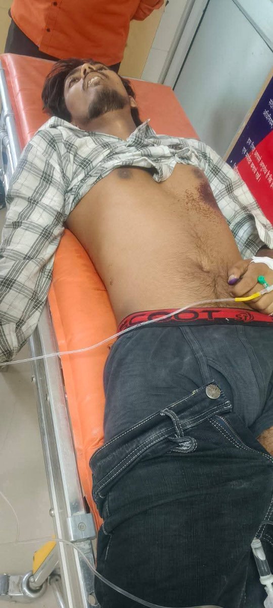 Drkuldeepbhargv's tweet photo. प्रयागराज के फाफामऊ में युवा साथी हिमांशु सरोज की दिन-दहाड़े गोली मारकर हत्या की घटना बेहद दुखद, शर्मनाक और कानून व्यवस्था पर बड़ा सवाल है।

जब अपराधी खुलेआम सड़कों पर हत्या कर रहे हों, तो यह साफ है कि अपराधियों के मन से कानून का डर खत्म हो चुका है।

उत्तर प्रदेश सरकार और @Uppolice से मांग है कि आरोपीको तत्काल गिरफ्तार कर फास्ट-ट्रैक कोर्ट के माध्यम से कड़ी से कड़ी सजा दिलाई जाए।
पीड़ित परिवार को न्याय और सुरक्षा सुनिश्चित की जाए।

दलित-बहुजन समाज पर बढ़ते हमले बेहद चिंताजनक हैं। अब सिर्फ बयान नहीं, कठोर कार्रवाई जरूरी है।

@dgpup @igrangealld @prayagraj_pol @LJP4India