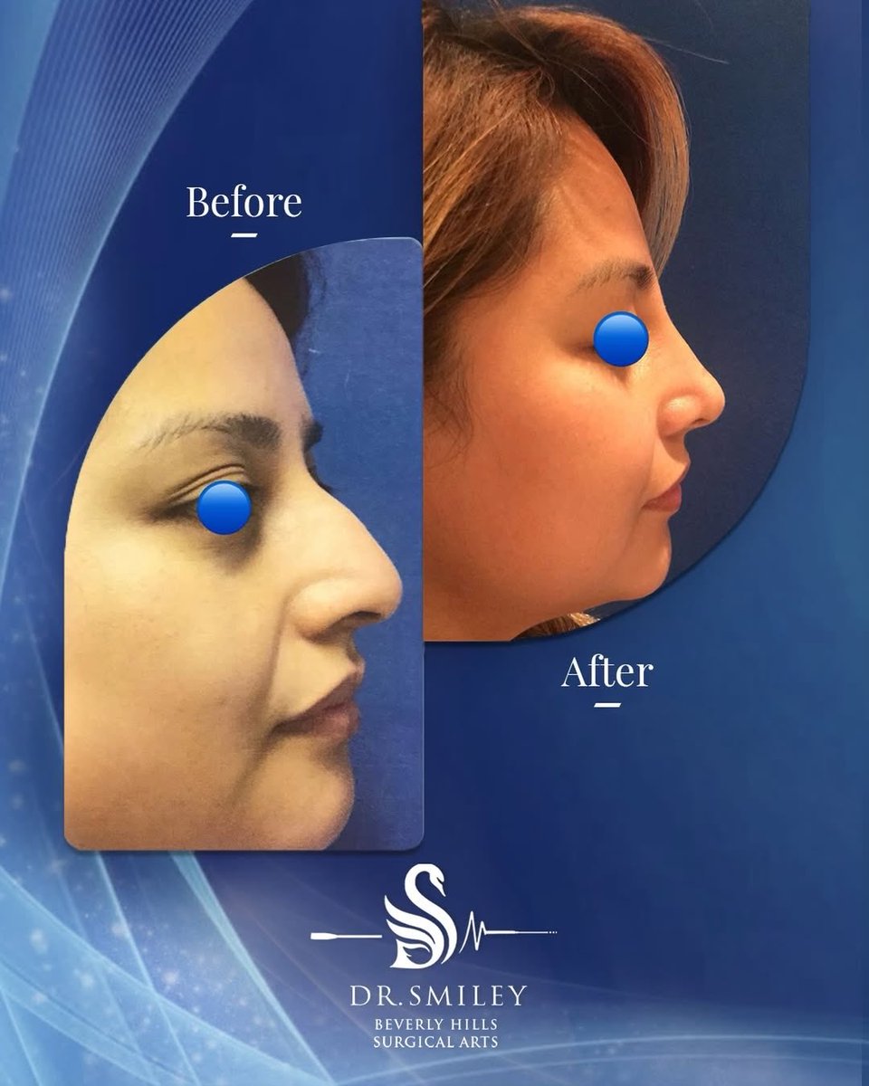 drsmiley_t's tweet photo. Giving 'striking a pose' a whole new meaning. 
Don't just follow the trend—set the standard with Dr. Smiley.

For consulting and reservation:

📞 Call us today: 1-866-372-3288 (Beverly Hills) | +971-50-505-3131 (Dubai) | +961-71-707-140 (Beirut) | +966-50-545-3131 https://t.co/MHsiILT0RS