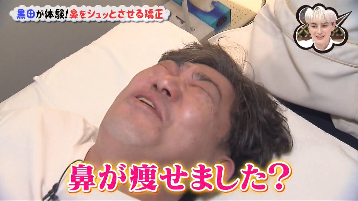 raplit_amn's tweet photo. 今回の放送では、
黒田有 さんが施術ご体験！

実際に若い頃のお写真と比較すると、
年齢と共に鼻の横幅や丸みが増した印象に。

施術後は…

「鼻が痩せました？」
「なんかスッキリしてる！」
と、同行された黒木アナからも驚きの声が♪

10分ほどの施術
ビフォアフの変化にスタジオでも盛り上がり！ https://t.co/SKoX2L7tKt