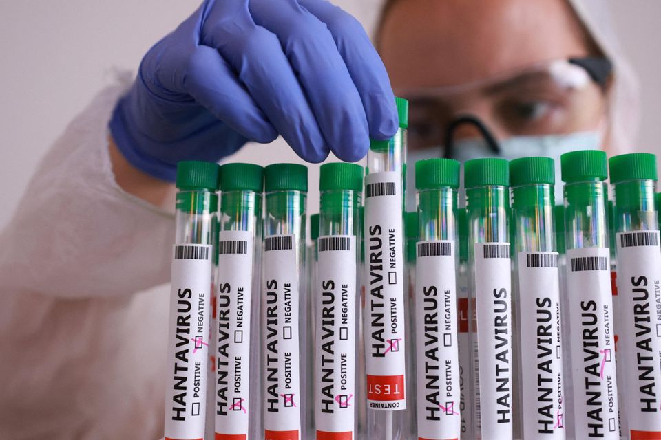 ActuCenter's tweet photo. 🔴🦠 ALERTE INFO - Une Française et un Américain ont été testés positifs à l’#Hantavirus aujourd’hui.

▶️ Des dizaines de cas contacts sous surveillance en France et aux États-Unis. https://t.co/8SJTTOfEha