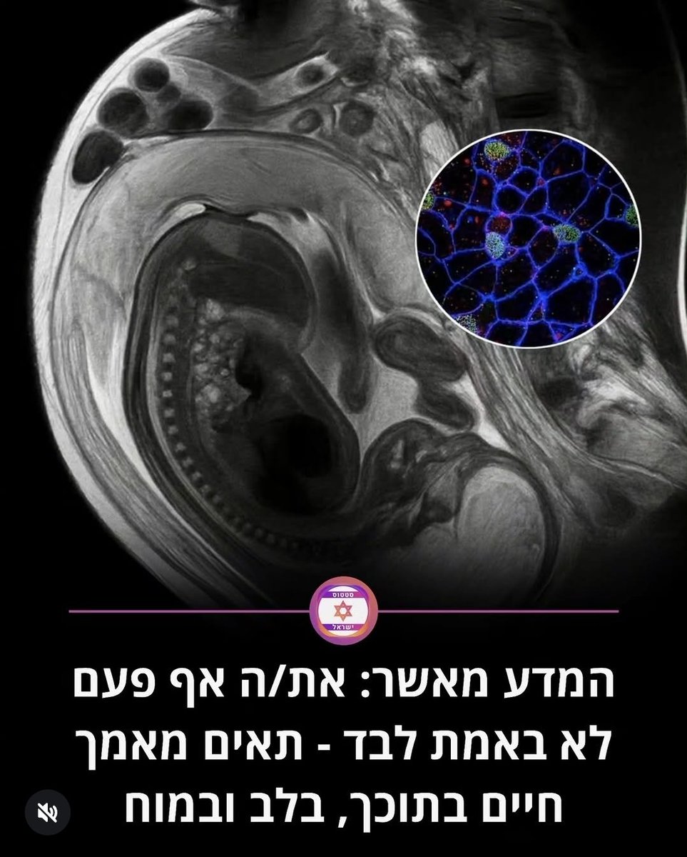lea71919's tweet photo. נרגעתי . העיקר לא של האבא. https://t.co/uLNcdaqywE