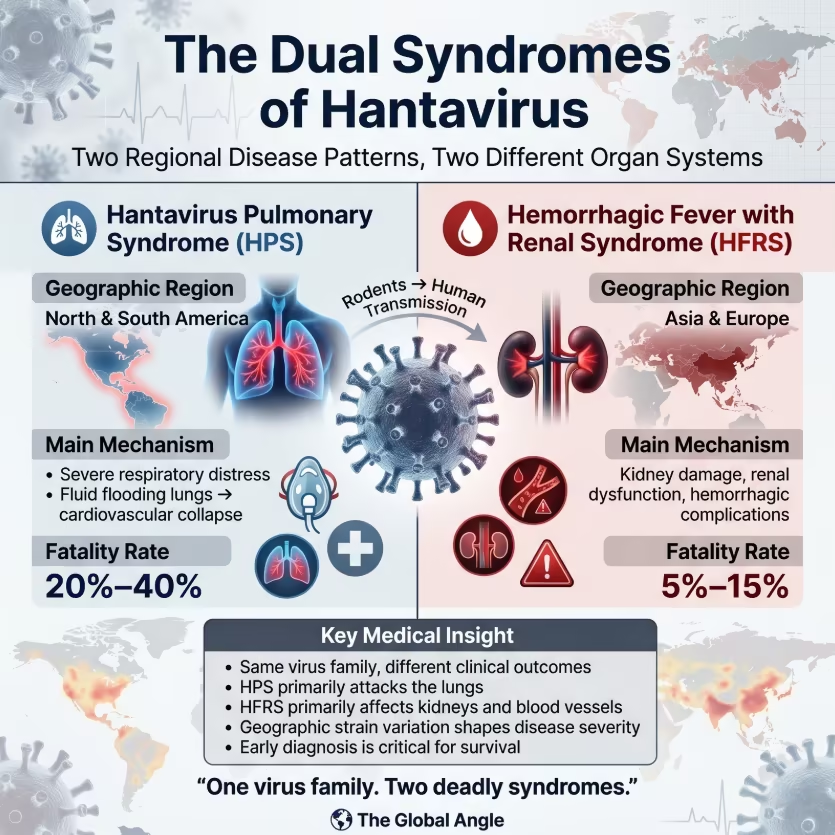 The_GlobalAngle's tweet photo. 🚨 The Hantavirus threat is escalating in 2026.

From the clinical transmission to the environmental triggers causing this sudden surge, we break down everything about this lethal zoonotic pathogen.

Why this outbreak is demanding attention: 👇

https://t.co/EEcHb5G7RH https://t.co/5JOuA3IRwM