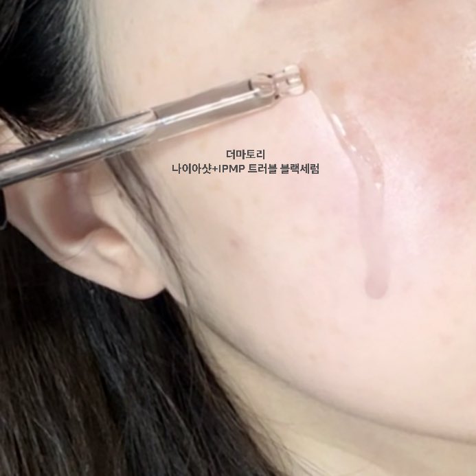 #광고 #RT이벤트 @dermatoty_kr
트러블1) 고민 있는 분들 주목..
 
트러블1) 연고로 유명한 일본 '페X 연고' 핵심 성분인 IPMP가 들어간 세럼이 있다..?! (진짜임) 출시하자마자 품절 대란난 더마토리 블랙세럼인데
 
연고는 국소 부위만 사용 가능하다면
이건 세럼이라 얼굴 전체2)를 매일매일