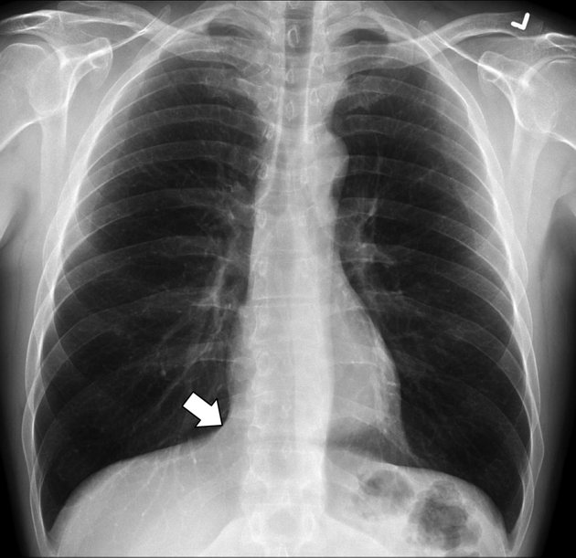 drsthanus's tweet photo. This is a 50-year-old male.

Is this radiograph normal or abnormal?

What structure is indicated by the arrow? https://t.co/YynthwhXYp