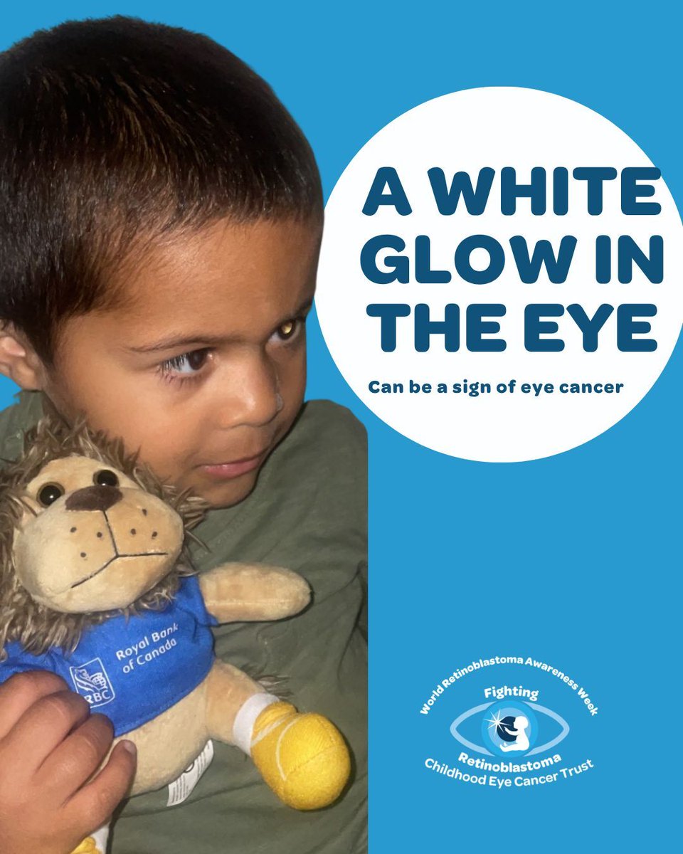ChectUK's tweet photo. If you see a white glow in the eye, a white pupil or white reflection in a photo where a flash has been used, or when your child is in artificial light or a darkish room, visit a GP or optometrist ASAP as this is the most common sign of retinoblastoma  #RbWeek https://t.co/H9tUc0GLlL